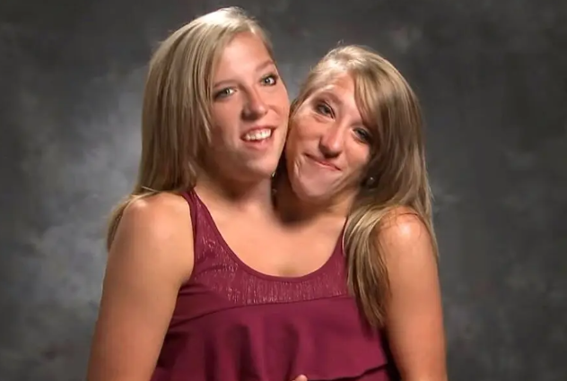 Abby And Brittany Hensel Pregnancy 10