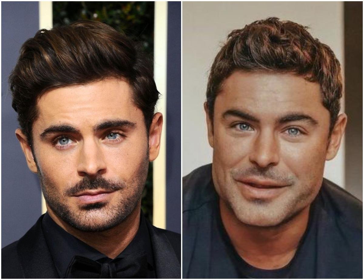 Zac Efron Chirurgie Visage : L'acteur américain a-t-il eu recours à la ...